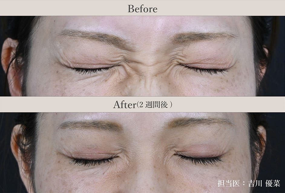 施術前後の症例写真