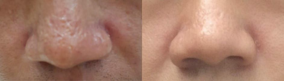 施術前後の症例写真