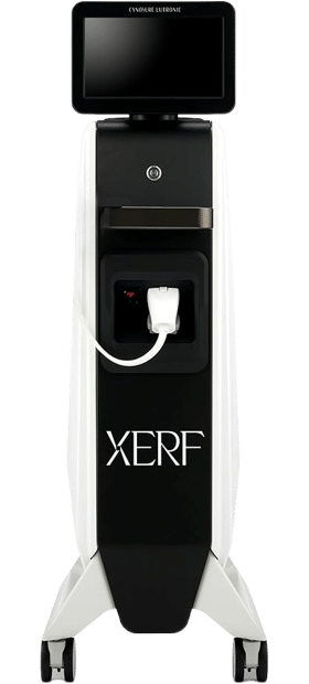 XERF