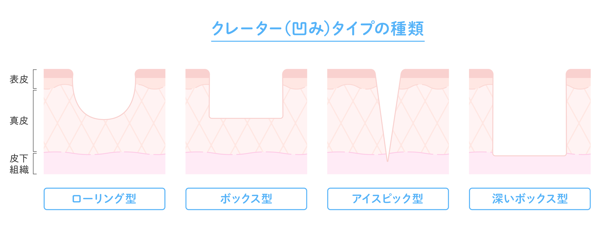 クレーターの種類