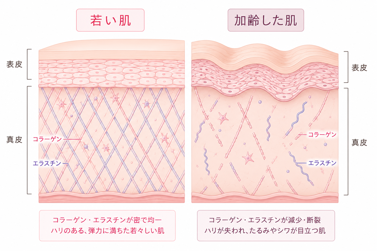 若い肌と加齢した肌のコラーゲン・エラスチンの比較