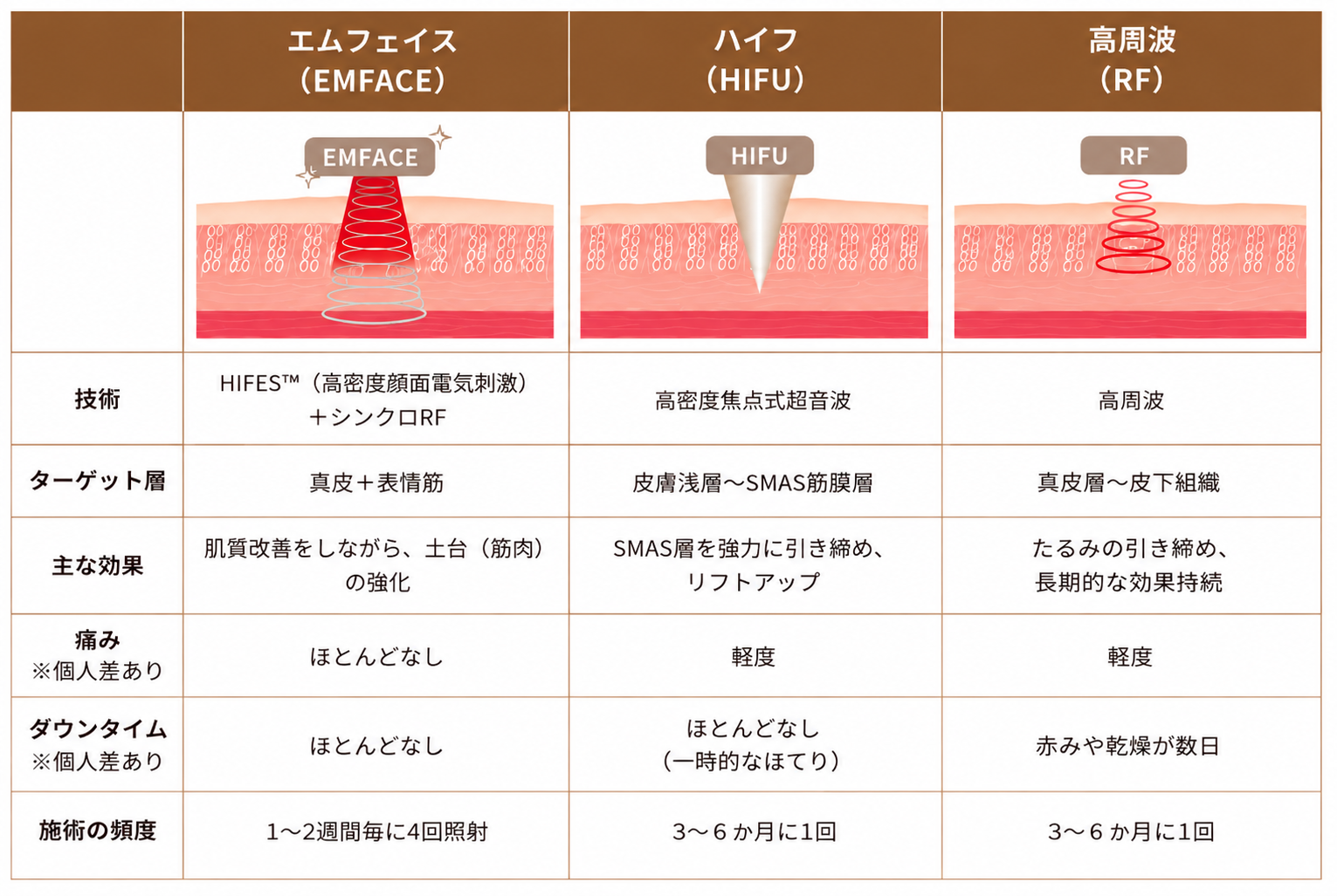 エムフェイスと他のたるみ治療の比較表