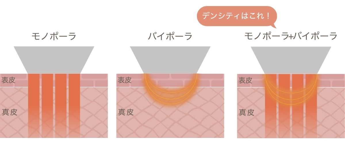 モノバイ